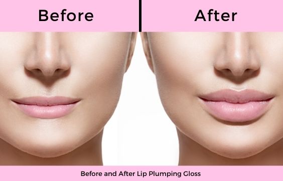 Image showing the before and after effects of lip plumping glosses